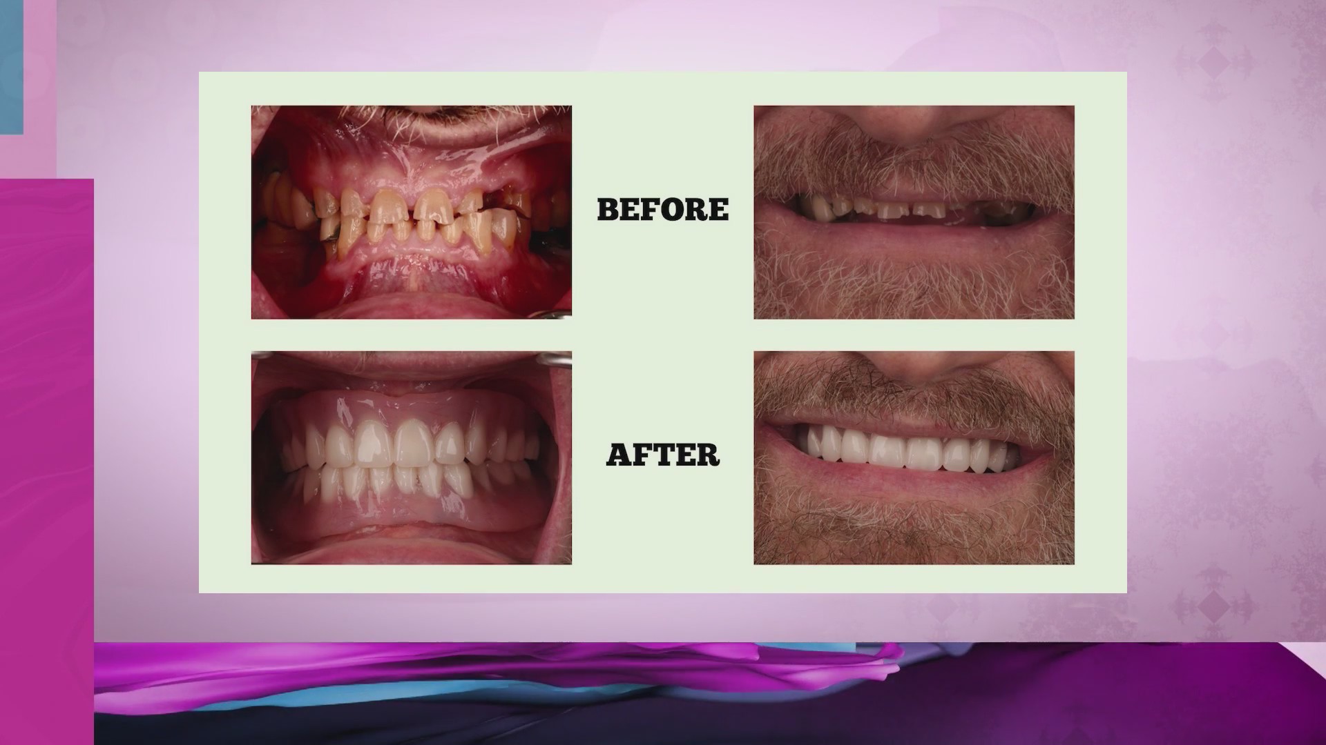 Options to transform your smile with board-certified Advanced Dental and Implant expertise