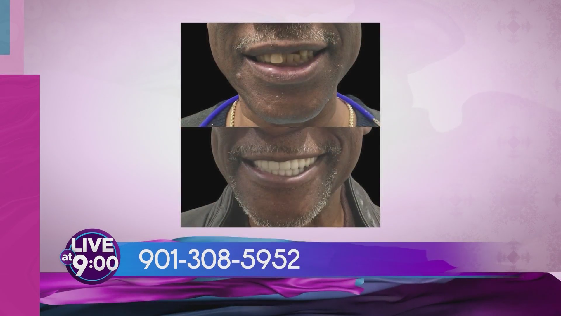 Reviving Your Smile with Memphis Dentures & Implants on Live at Nine!