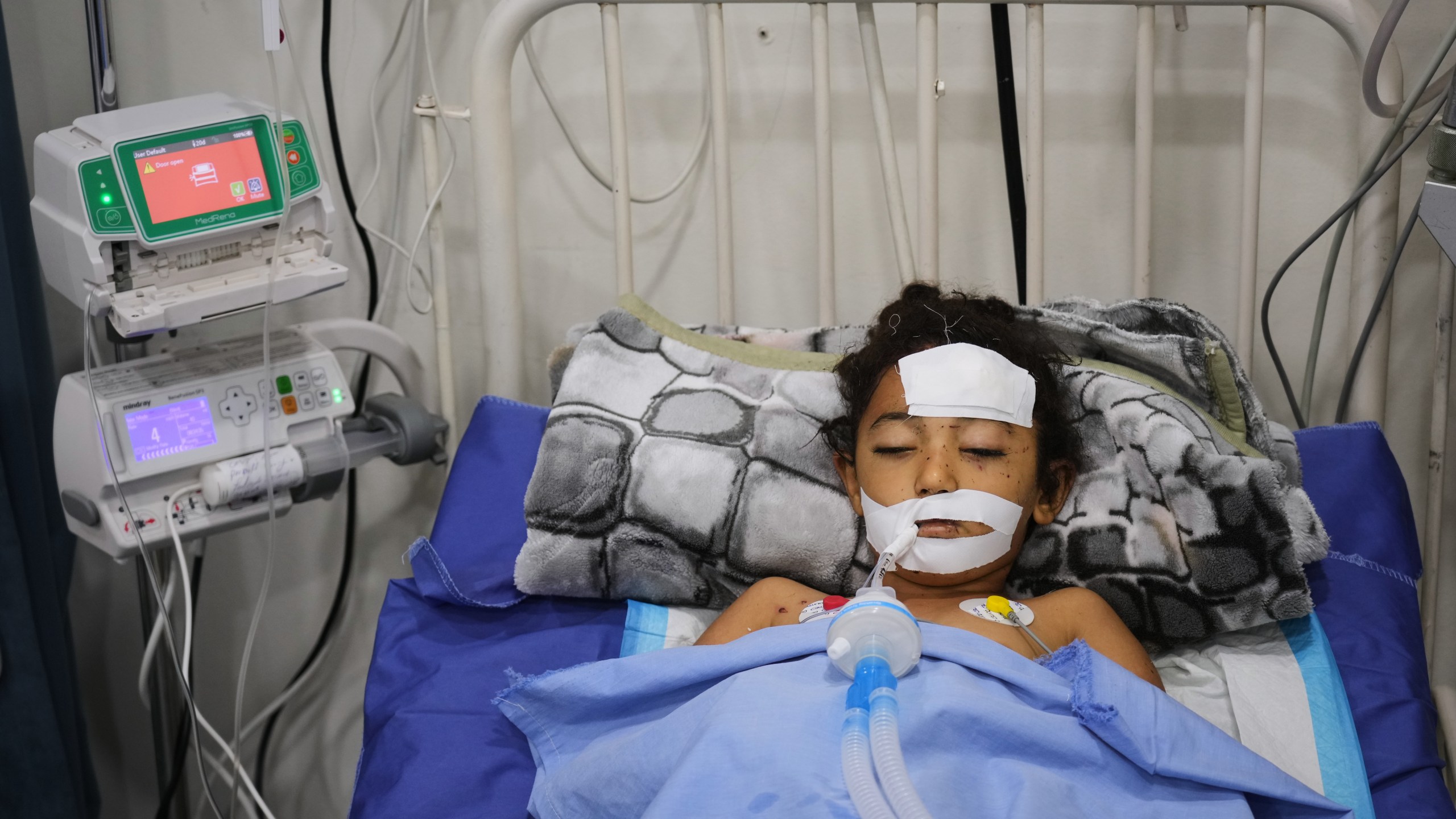 Nabila Shorbasi, who was injured by an unexploded ordnance along with her six-year-old twin brother Yahya, lies on a bed at Patient's Friends Charity Hospital in Gaza City, Saturday, Oct. 25, 2025. (AP Photo/Abdel Kareem Hana)