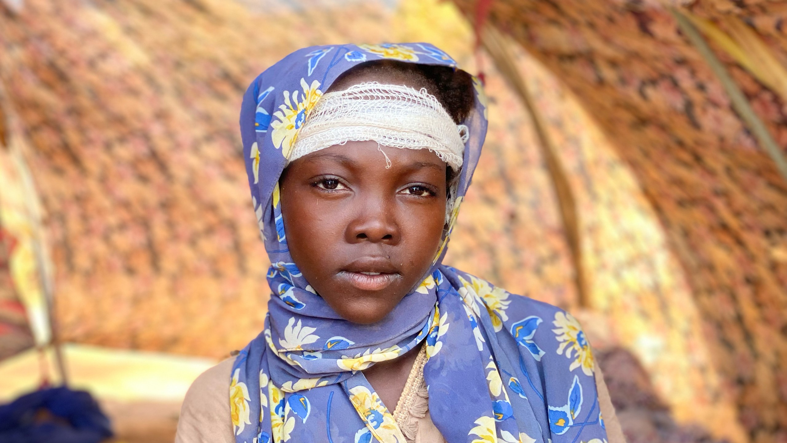 Khawater Mohammed, an injured Sudanese who fled el-Fasher city, after Sudan's paramilitary forces killed hundreds of people in the western Darfur region, receives medical care at a camp in Tawila, Sudan, Thursday, Oct. 30, 2025. (AP Photo/Mohammed Abaker)